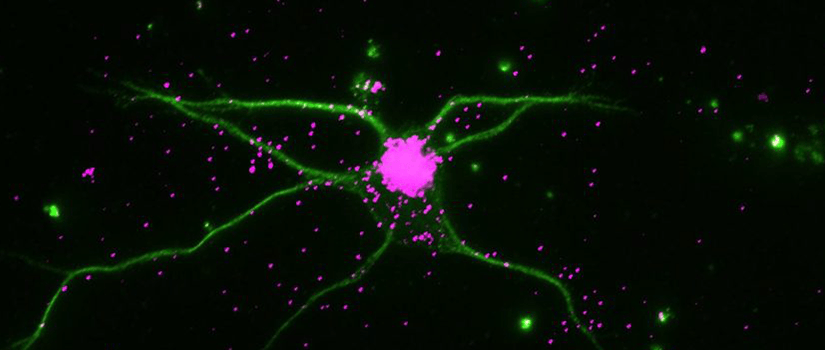 Fluorescent microscope image showing a neuron in green with branching dendrites and clustered magenta protein markers, highlighting neural connections and synaptic activity in a research study.
