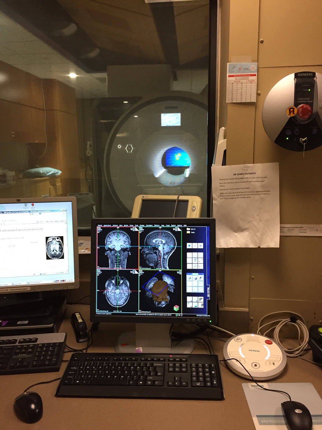 fmri