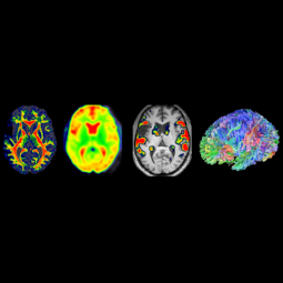 brain scans